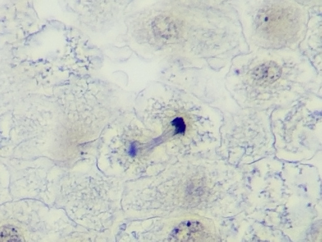 White Fish Mitosis Slides - White Fish Mitosis 07 400X